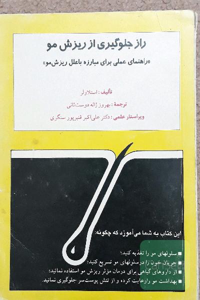راز جلوگیری از ریزش مو